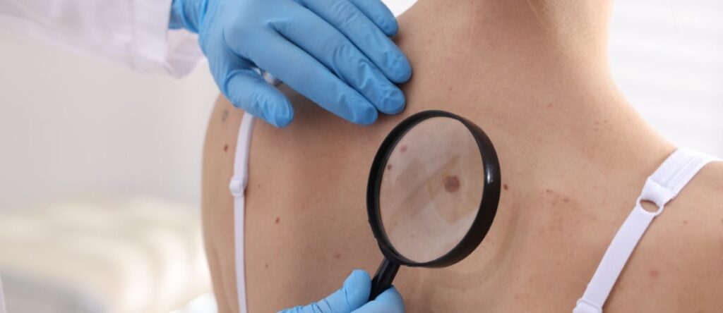 visita dermatologica casilina