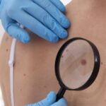 visita dermatologica casilina